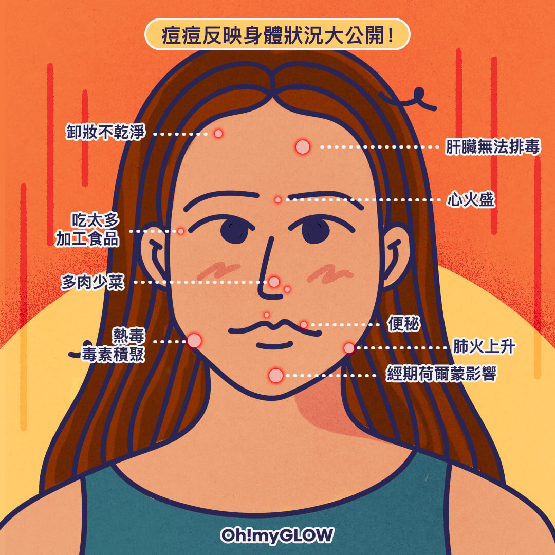 痘痘反映身體狀況大公開！
