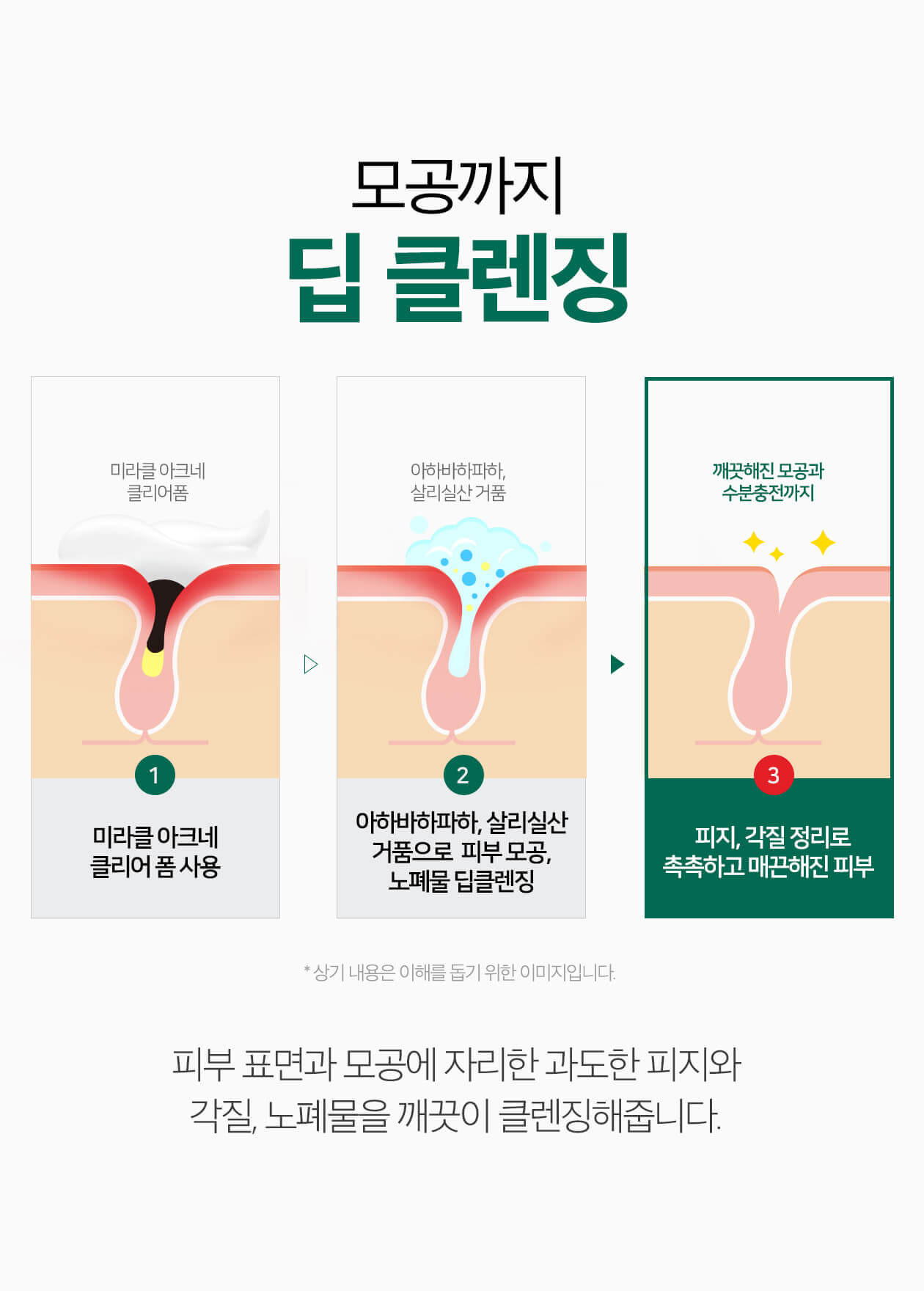 韓國Some By Mi AHA BHA PHA 30 Days Miracle AC SOS Kit 30天奇蹟修復4件套裝