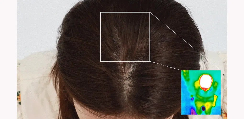 韓國 B Project Stay Hair Scalp Intensive Ampoule 頭皮髮根集中修護生髮精華 - 100ml