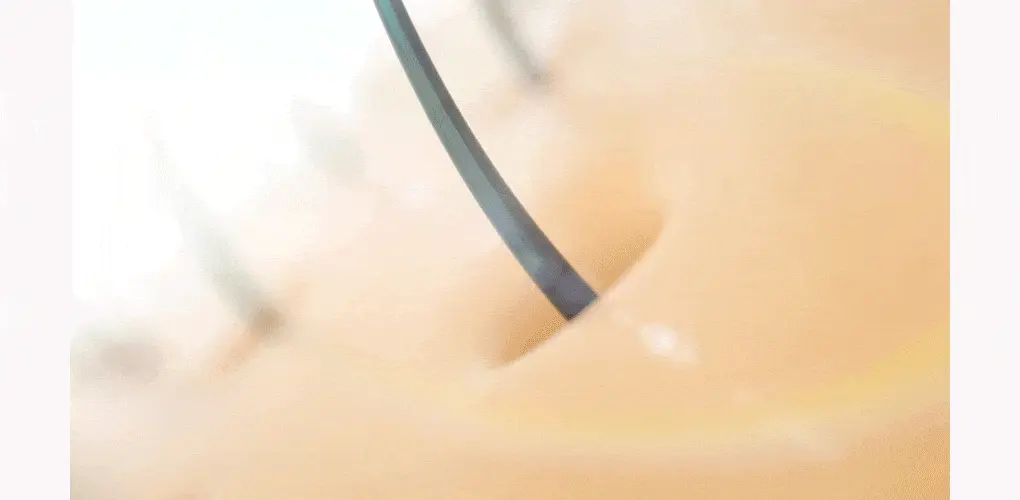 韓國 B Project Stay Hair Scalp Intensive Ampoule 頭皮髮根集中修護生髮精華 - 100ml