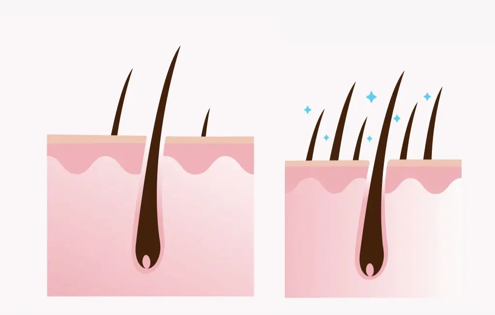 韓國 B Project Stay Hair Scalp Intensive Ampoule 頭皮髮根集中修護生髮精華 - 100ml