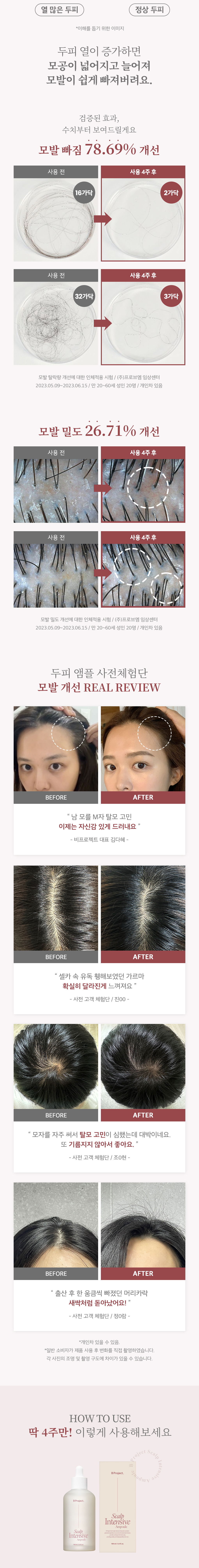 韓國 B Project Stay Hair Scalp Intensive Ampoule 頭皮髮根集中修護生髮精華 - 100ml