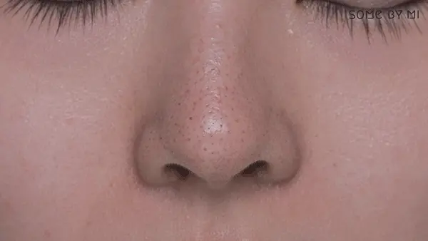 〖5分鐘洗走黑頭〗韓國 Some By Mi BYE BYE BLACKHEAD 30 Days Miracle Green Tea Tox Bubble Cleanser 30天奇蹟去黑頭綠茶深清泡泡潔面