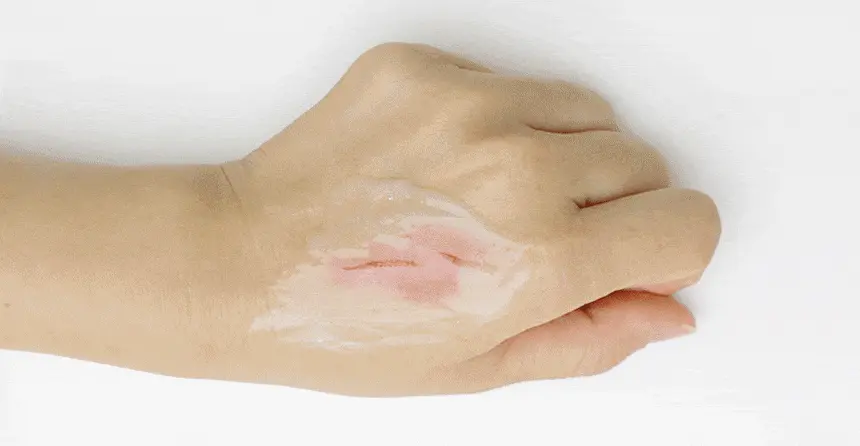 韓國 ilso Sensitive Bubble Relaxing Cleanser 積雪草 X Ceramide 抗敏清黑頭泡泡潔面 - 200g