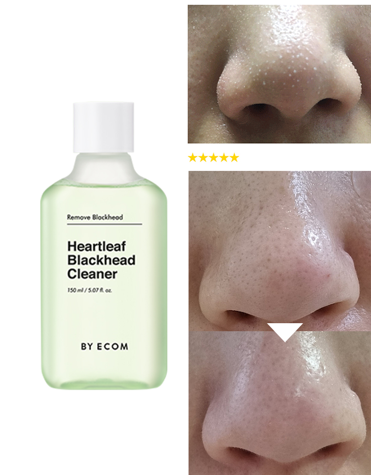 韓國 BYECOM Heartleaf Blackhead Cleaner 魚腥草清黑頭收毛孔黑頭導出液