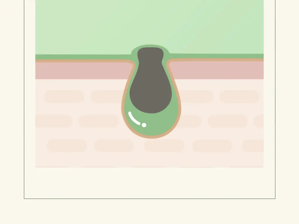 韓國 BYECOM Heartleaf Blackhead Cleaner 魚腥草清黑頭收毛孔黑頭導出液