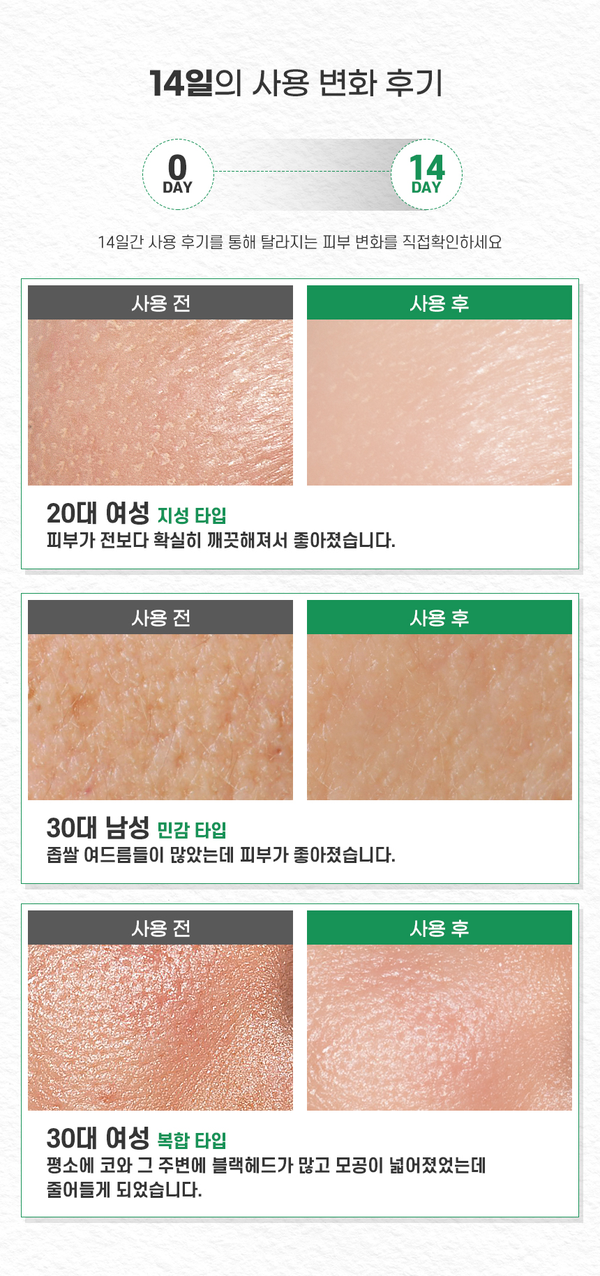 韓國 Natural Base T Calming Soothing Mask Pack 有機茶樹積雪草鎮靜面膜 10片裝〔最新包裝〕