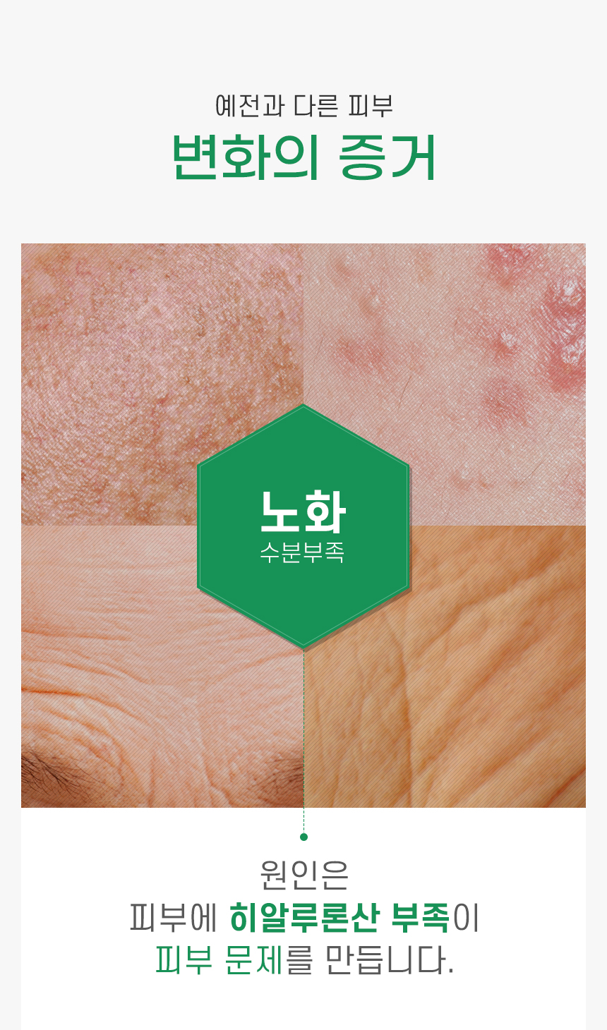 韓國 Natural Base T Calming Soothing Mask Pack 有機茶樹積雪草鎮靜面膜 10片裝〔最新包裝〕