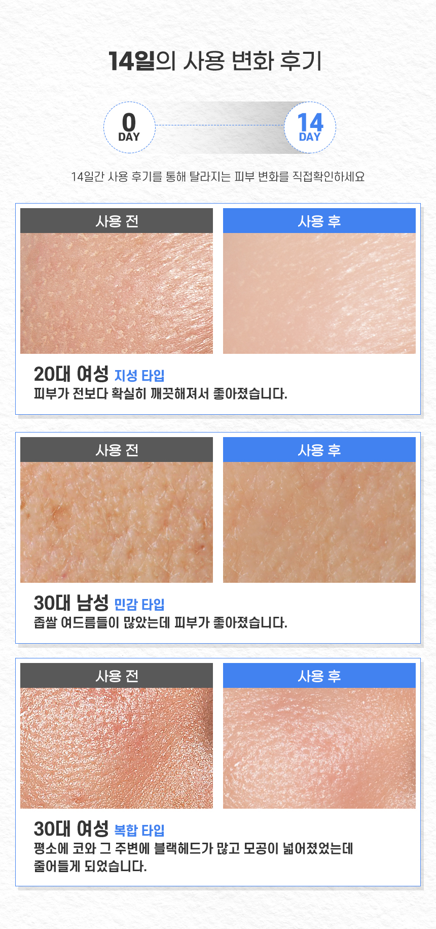 韓國 Natural Base 6-HA Blue Vital Mask Pack 藍色活力復活草保濕面膜 10片裝〔最新包裝〕