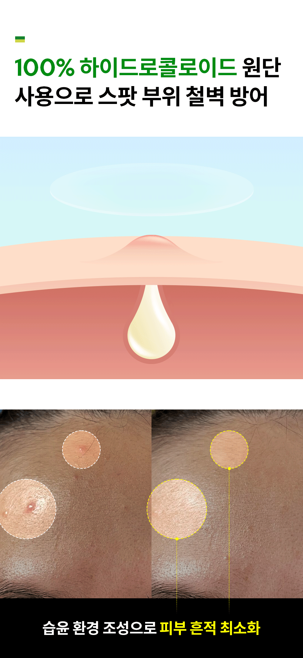 韓國 Troubless Invisible Spot Patch #Classic 極透薄隱形痘痘貼 - 96片裝