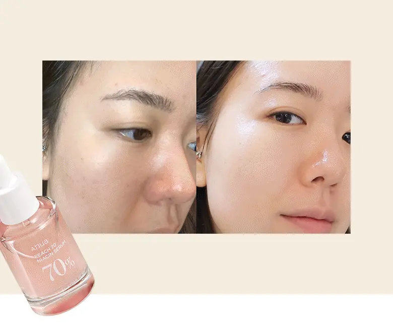 韓國 ANUA Peach 70 Niacin Serum 🍑保濕提亮美肌活力桃花精華