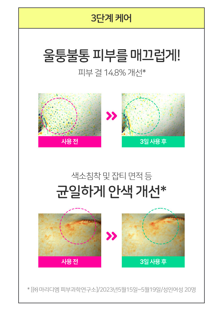 \New! 全新3天精華高效精華/ 油痘粗糙肌~韓國 Bring Green Zinc Teca 1.2% Blemish Serum 高效能積雪草維B3收毛孔提亮淡痘印精華 - 25ml