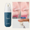 韓國 B Project Bye Blackhead Melting Remover 告別黑頭溶解清毛孔黑頭白頭導出酵素精華連清潔刷頭