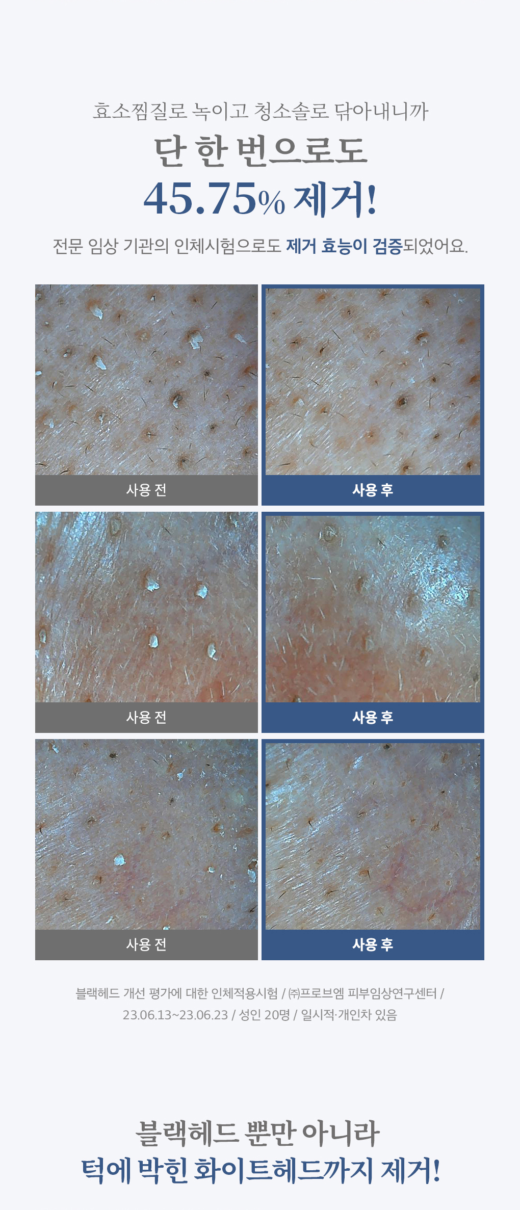 韓國 B Project Bye Blackhead Melting Remover 告別黑頭溶解清毛孔黑頭白頭導出酵素精華連清潔刷頭