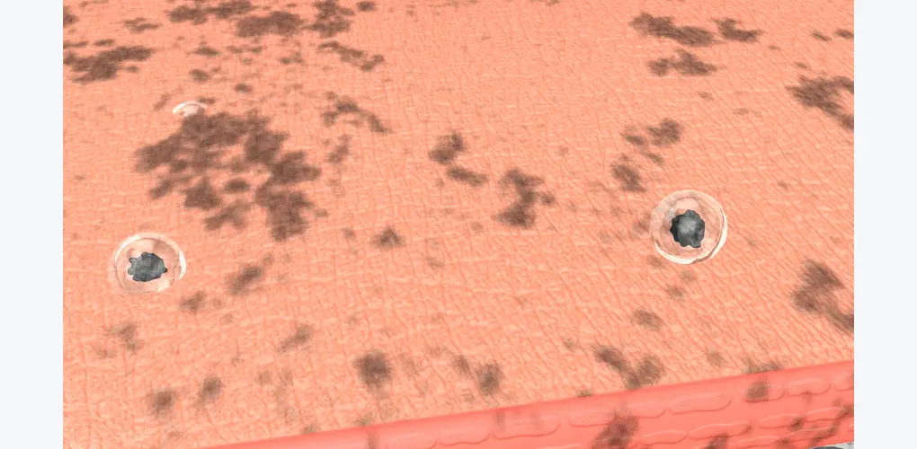 韓國 B Project Bye Blackhead Melting Remover 告別黑頭溶解清毛孔黑頭白頭導出酵素精華連清潔刷頭