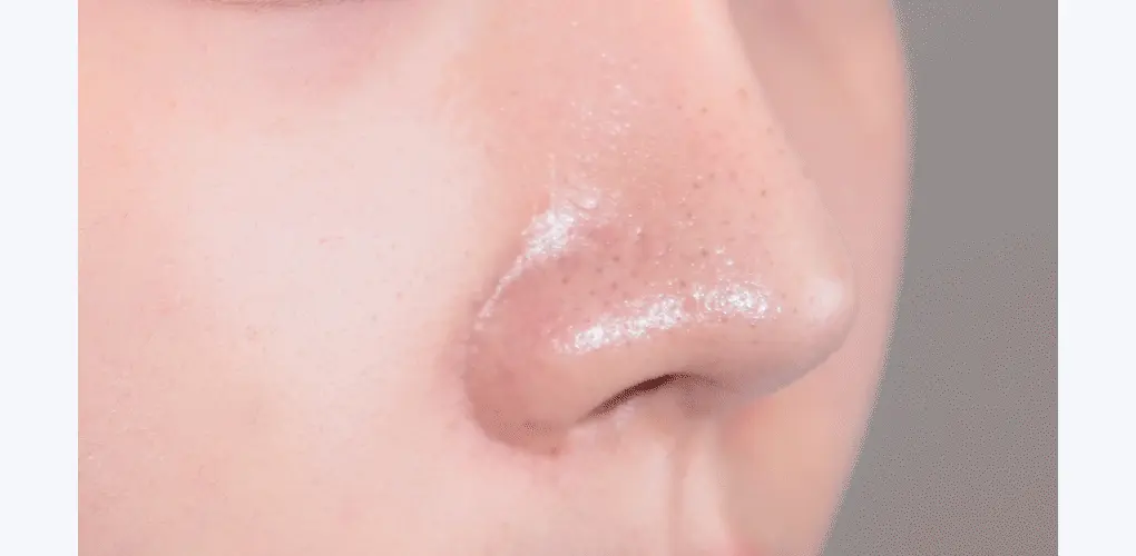 韓國 B Project Bye Blackhead Melting Remover 告別黑頭溶解清毛孔黑頭白頭導出酵素精華連清潔刷頭