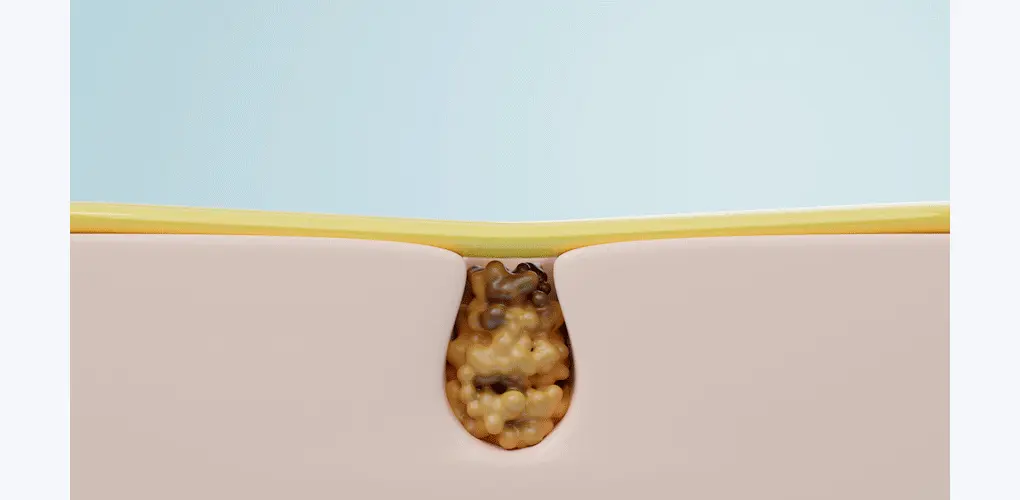 韓國 B Project Bye Blackhead Melting Remover 告別黑頭溶解清毛孔黑頭白頭導出酵素精華連清潔刷頭