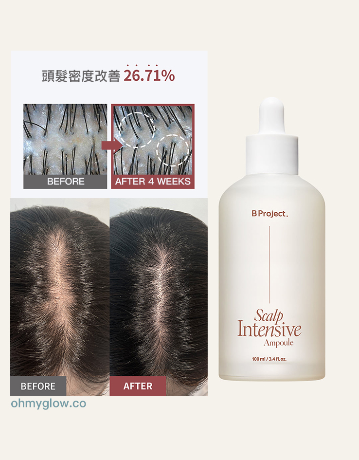 韓國 B Project Stay Hair Scalp Intensive Ampoule 頭皮髮根集中修護生髮精華 - 100ml