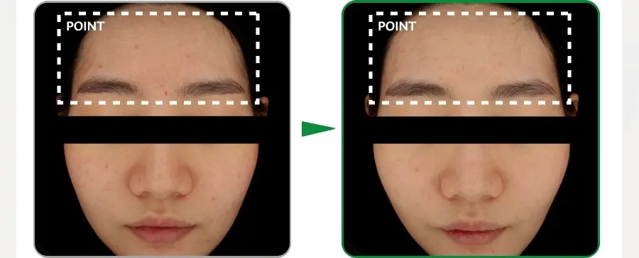 \第2代新升級版/韓國 Medi Peel Green Cica Collagen B5 Clear 2.0 積雪草膠原蛋白洗面乳 - 300ml