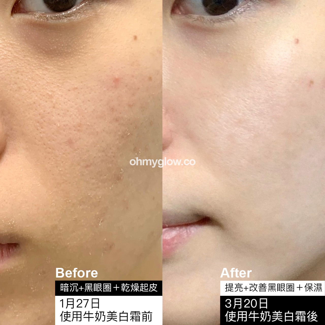 溫和淡印亮膚~韓國 Clean Beauty 品牌 HeveBlue【🏆GlowPick No.1】Milk Rice Liposome Shot Whitening Cream 牛奶米脂體注射美白面霜