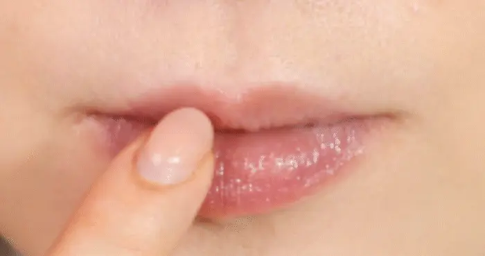 【化解護唇No.1】唇死皮救星!韓國 KOCOSTAR Peach Duo Duo Lip Scrub & Lip Oil In Cream 水蜜桃嘟嘟唇2 In 1 護理(唇磨砂+護唇霜)