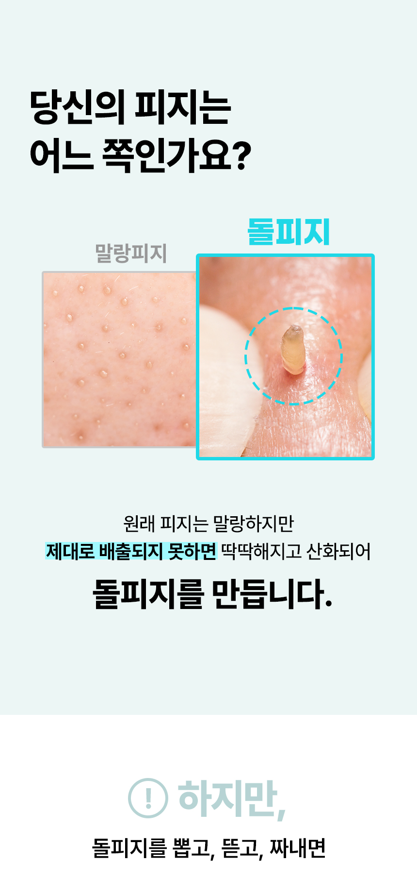 韓國 ilso Super Melting Sebum Softener 黑頭粉刺導出液