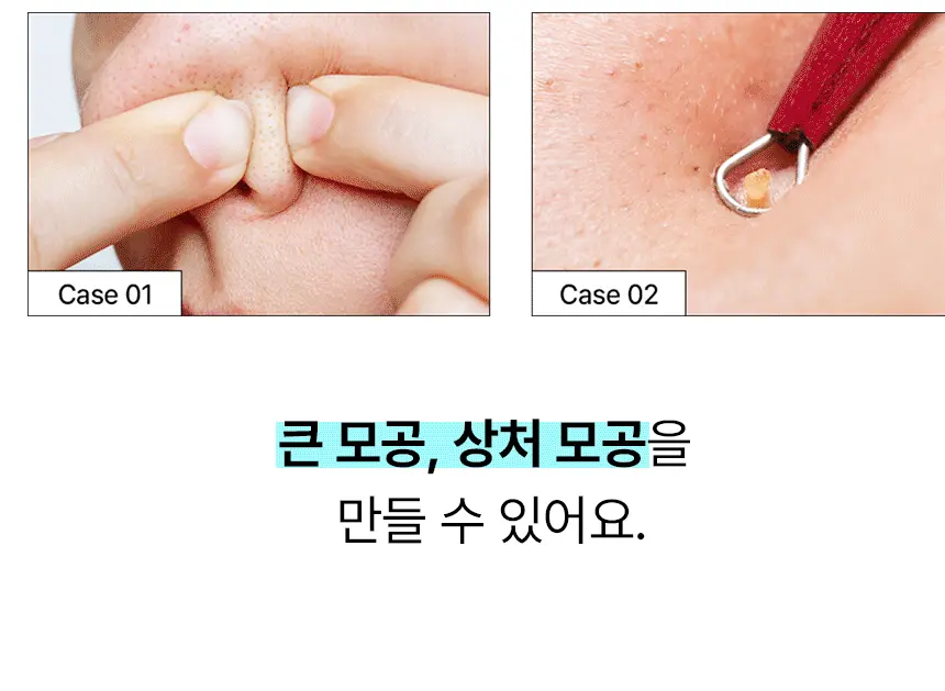 韓國 ilso Super Melting Sebum Softener 黑頭粉刺導出液