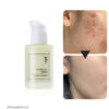 去紅淡斑去痘印！韓國 numbuzin No.5 Goodbye Blemish Serum 5號告別瑕疵精華 - 50ml
