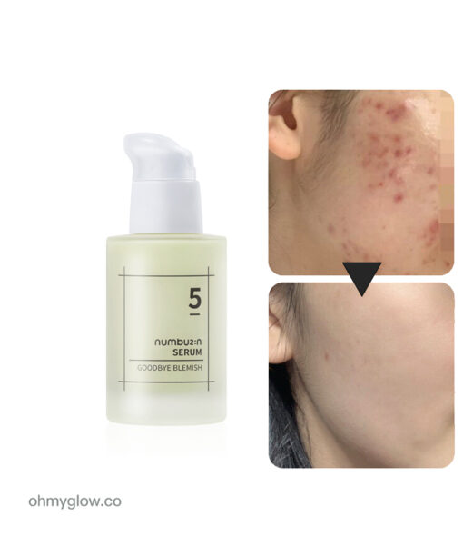 去紅淡斑去痘印！韓國 numbuzin No.5 Goodbye Blemish Serum 5號告別瑕疵精華 - 50ml