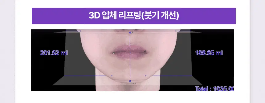 24年新強效升級版～立體提拉⭐韓國 Bio Heal BOH Probioderm 3D Lifting Ampoule 3維立體提拉彈力抗皺抗老益生菌多勝肽安瓶
