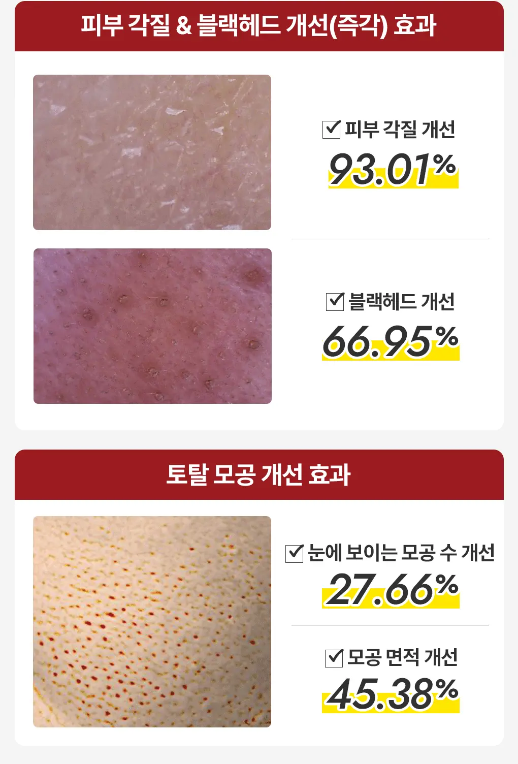 韓國 推介黑頭粗糙肌～MediHeal Phyto-Enzyme Peeling Pad 植物酵素角蛋白去角質死皮爽膚棉片 - 90片裝