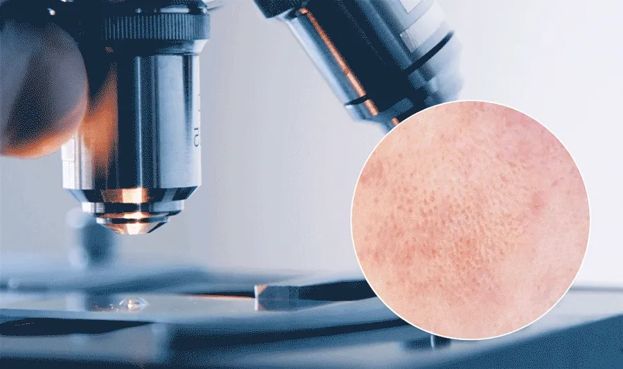 新升級2.0!韓國 Medi Peel Extra Super 9+ Blackhead Care Solution 2.0 黑頭清道夫淨鼻清潔液 - 250ml