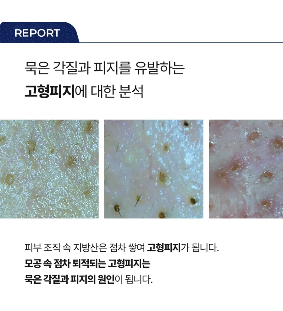 新升級2.0!韓國 Medi Peel Extra Super 9+ Blackhead Care Solution 2.0 黑頭清道夫淨鼻清潔液 - 250ml