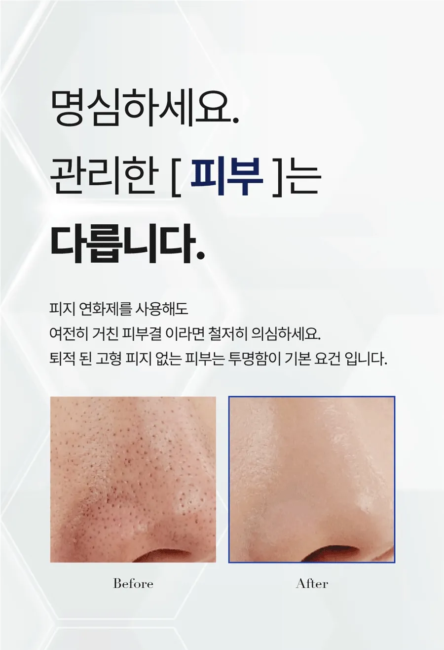 新升級2.0!韓國 Medi Peel Extra Super 9+ Blackhead Care Solution 2.0 黑頭清道夫淨鼻清潔液 - 250ml