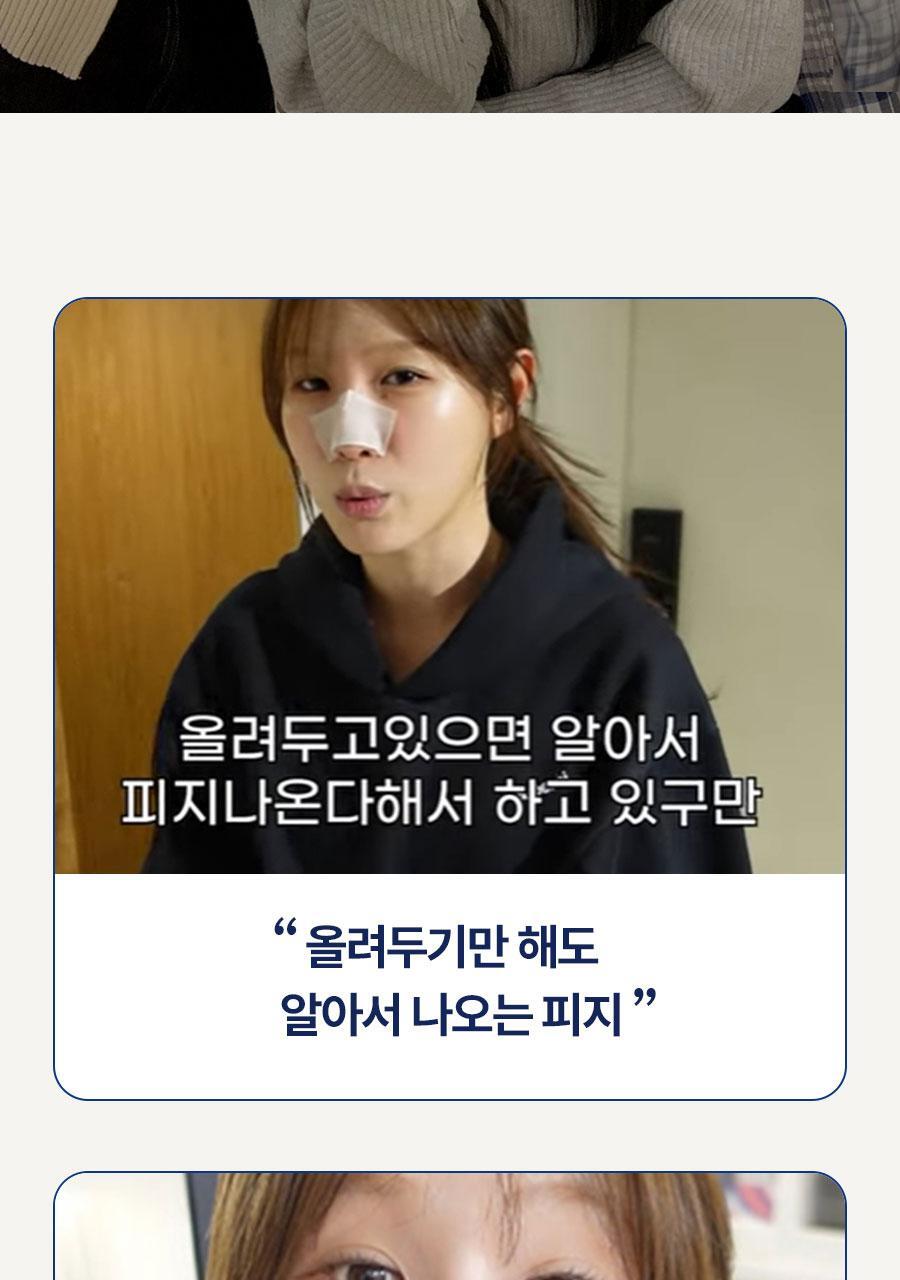 新升級2.0!韓國 Medi Peel Extra Super 9+ Blackhead Care Solution 2.0 黑頭清道夫淨鼻清潔液 - 250ml