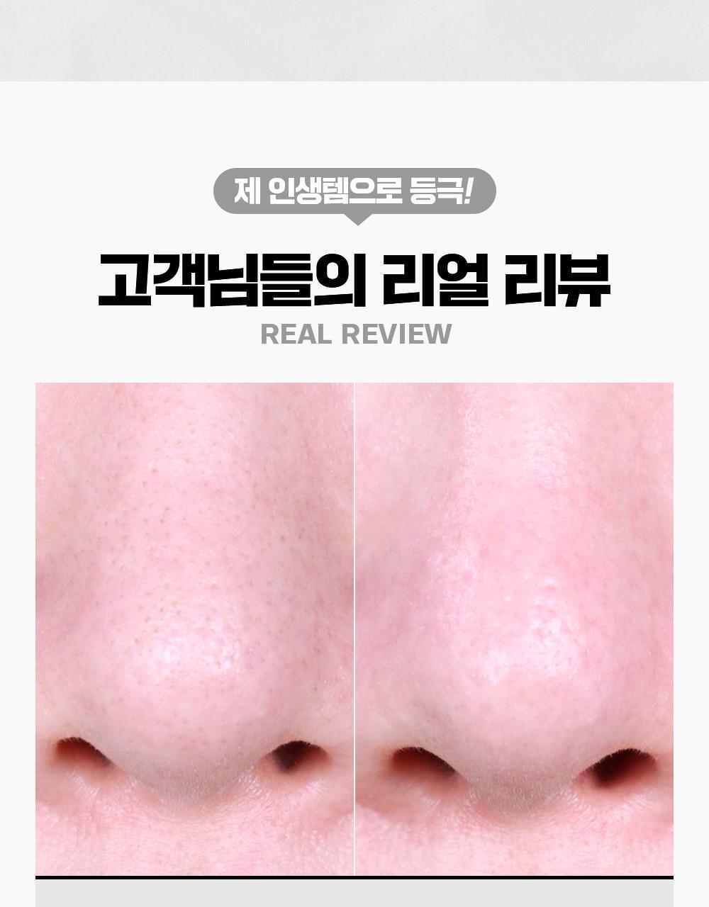 韓國Sungboon Editor Blackhead Melting Clear Pad 溶解黑頭導出鼻頭深清棉片 - 30片裝