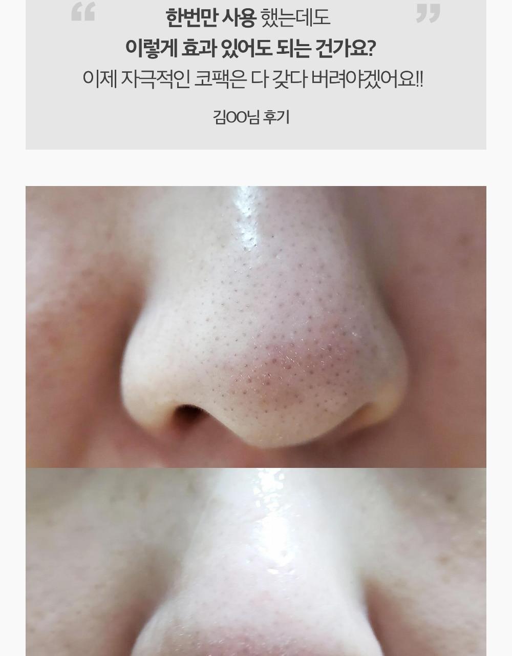 韓國Sungboon Editor Blackhead Melting Clear Pad 溶解黑頭導出鼻頭深清棉片 - 30片裝