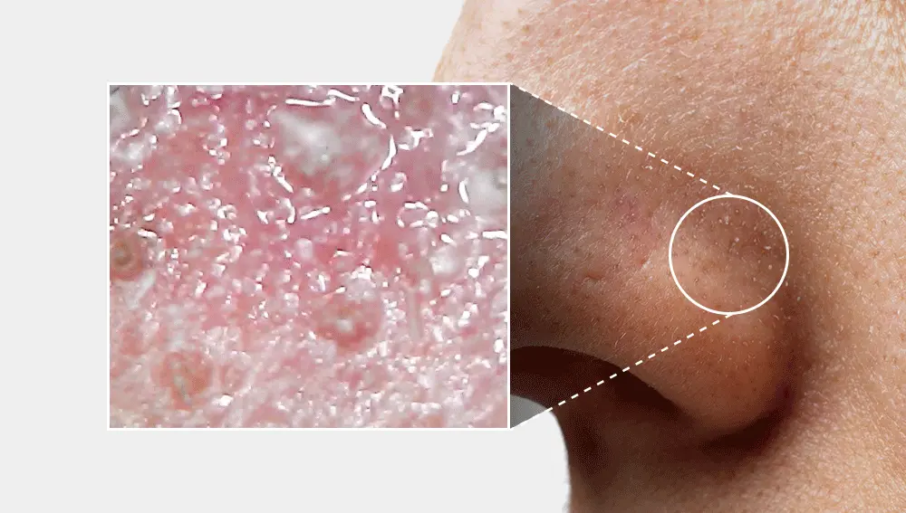 韓國 Sungboon Editor Green Tomato Pore Peeling Jumbo Pad 綠番茄緊緻收毛孔角質護理爽膚棉片- 60片裝