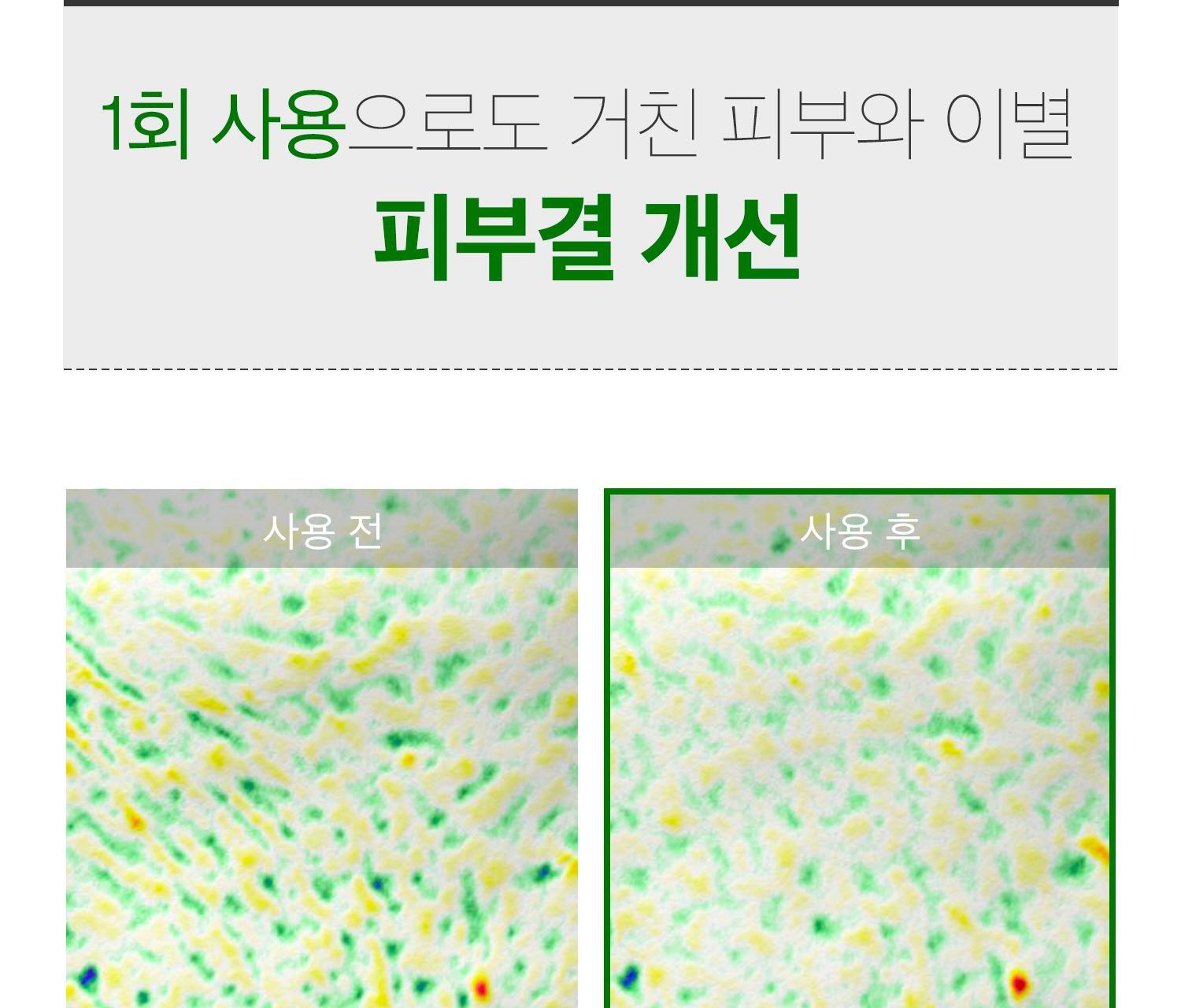 收毛孔!改善凹凸洞~韓國 VT cosmetics Reedle Shot 300 積雪草塗抹式微針300精華 - 50ml