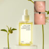 2週去斑去痘印～韓國 One Thing Niacinamide Blemish Care Serum 菸鹼醯胺維B美白去斑精華 - 50ml