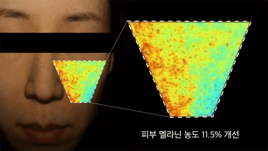 2週去斑去痘印~韓國 One Thing Niacinamide Blemish Care Serum 菸鹼醯胺維B美白去斑精華 - 50ml