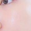 韓國 Olive Young皇牌得奬暗瘡貼～Care Plus Scar Cover Spot Patch 消痘暗瘡貼 102片裝