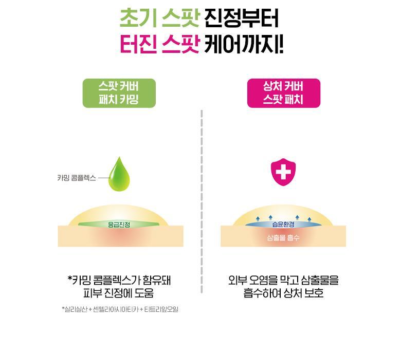 韓國 Olive Young 皇牌暗瘡貼~Care Plus Scar Cover Spot Patch Calming 消痘暗瘡貼綠色鎮靜款 96片裝