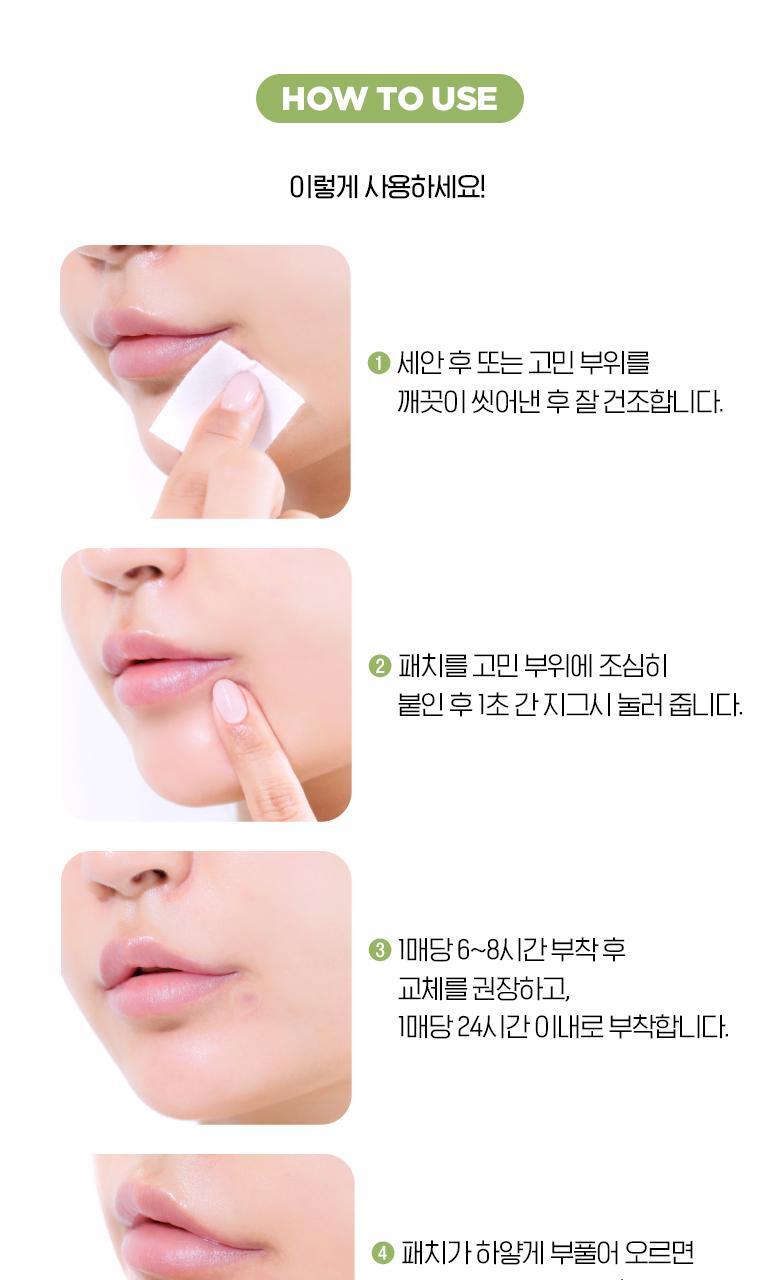 韓國 Olive Young 皇牌暗瘡貼~Care Plus Scar Cover Spot Patch Calming 消痘暗瘡貼綠色鎮靜款 96片裝