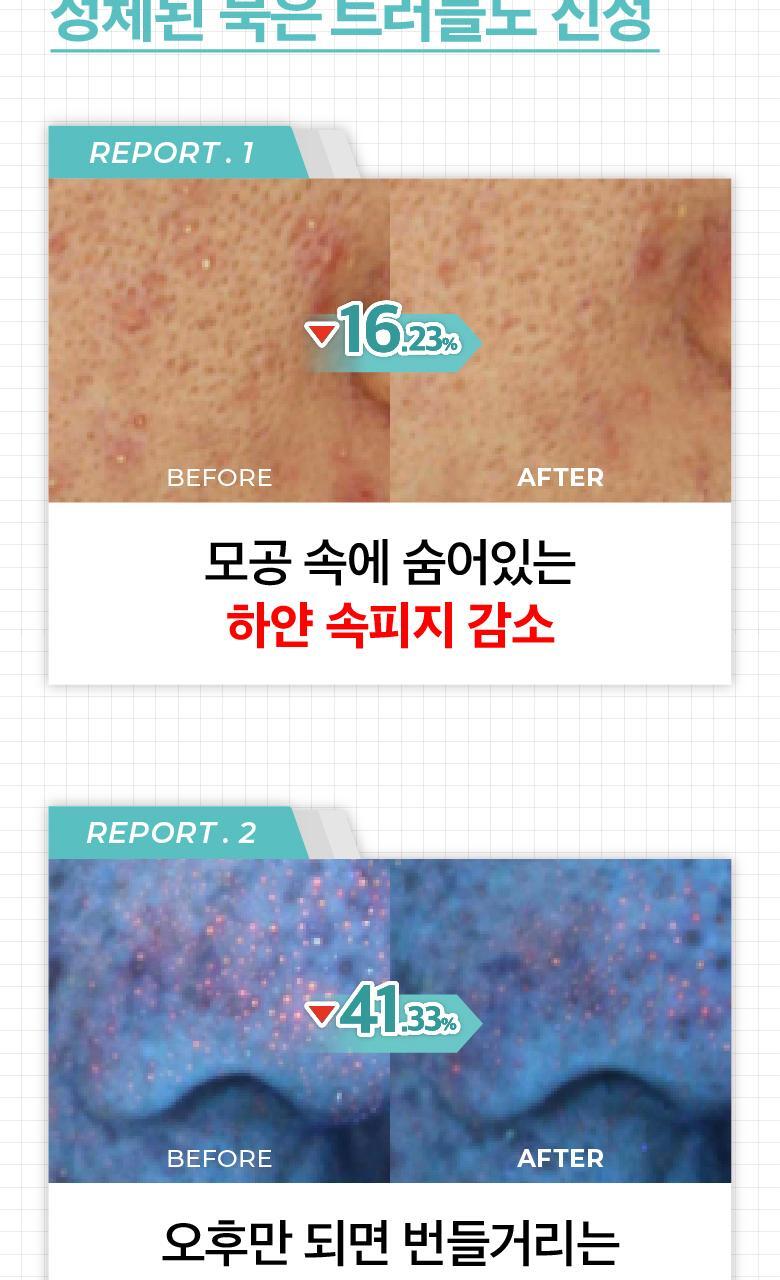 根源解決皮脂粉刺~韓國 numbuzin Pantothenic B5 Active Soothing Cream 活性泛酸B5控油舒緩保濕啫喱面霜 - 80ml