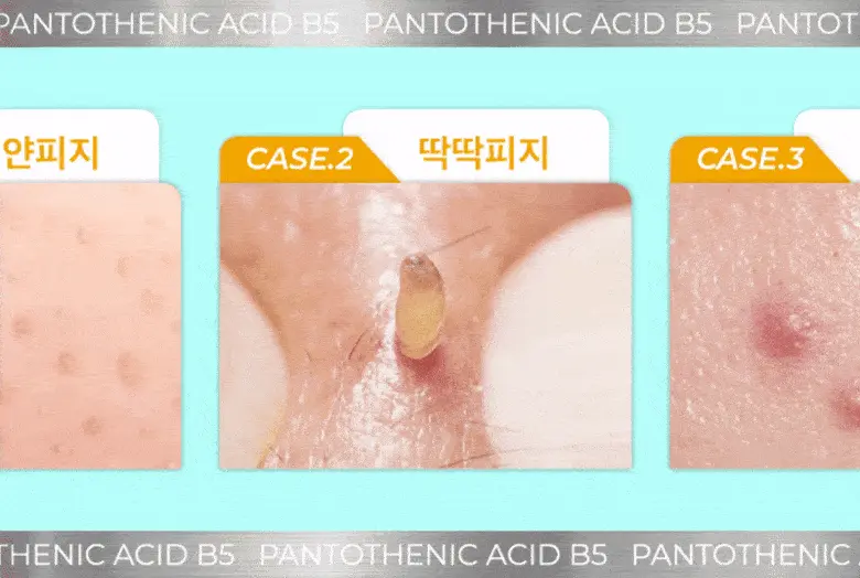 根源解決皮脂粉刺~韓國 numbuzin Pantothenic B5 Active Soothing Cream 活性泛酸B5控油舒緩保濕啫喱面霜 - 80ml