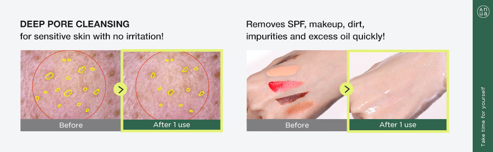 推介敏感毛孔粗糙肌~韓國 Anua Heartleaf Pore Cleansing Oil MILD 魚腥草溶解黑頭粉刺清毛孔卸妝油(溫和版) - 200ml