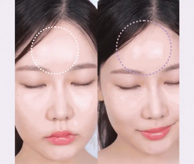 去額頭紋撫平眉頭紋【送膠原蛋白噴霧】～韓國 BioHeal BOH Probioderm Melting Collagen Deep Shot Forehead Film 納米級96.8%高濃度純膠原蛋白微射回彈提拉額頭膜- 5片裝