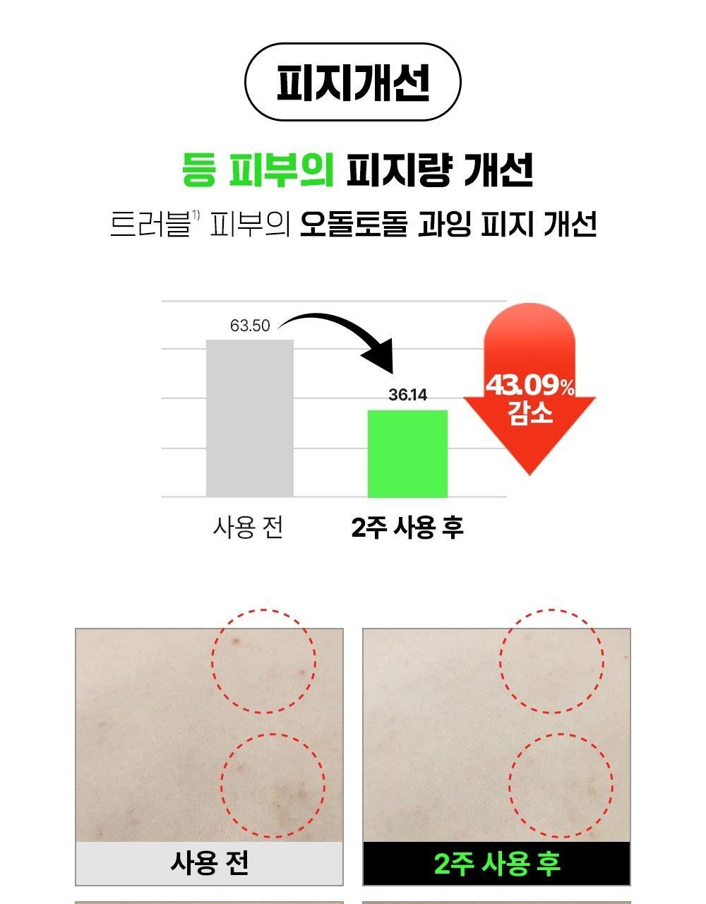 2週美背消痘~韓國 FATION Nosca9 Trouble Body Mist 抗痘去粒粒身體噴霧 - 145ml