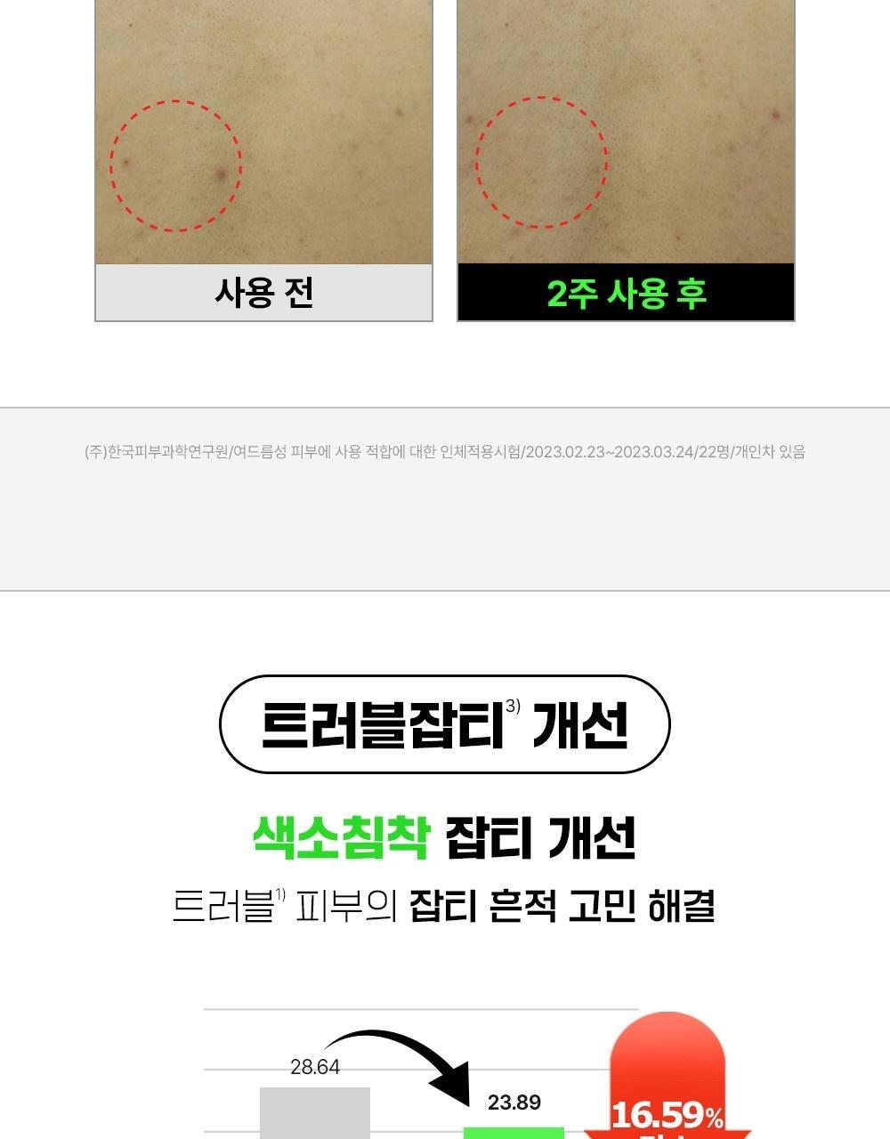 2週美背消痘~韓國 FATION Nosca9 Trouble Body Mist 抗痘去粒粒身體噴霧 - 145ml